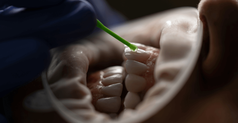Merrylee Dental Practice Teeth Polish